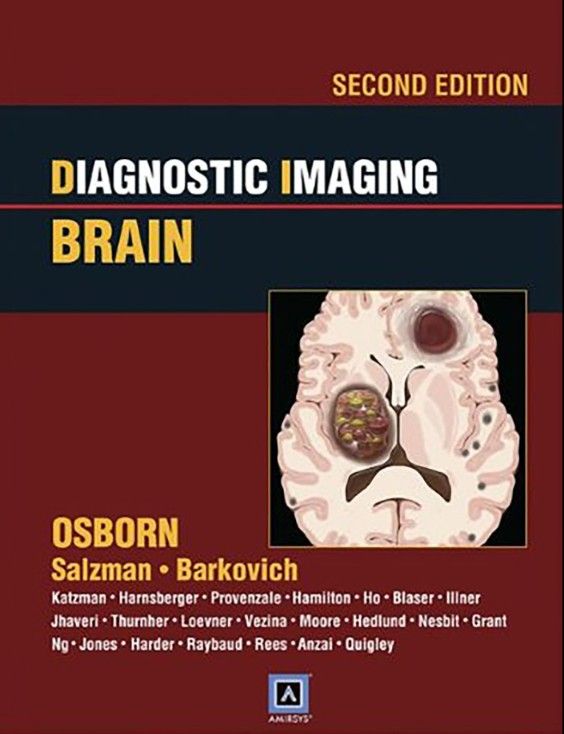 Diagnostic Imaging: Brain